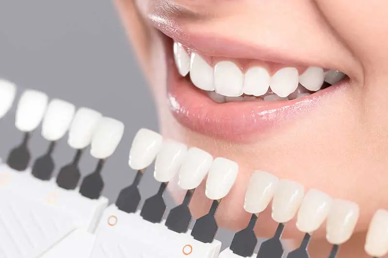 Dr. Roberts provides teeth whitening cosmetic dentistry solutions in Placer, CA to brighten your smile